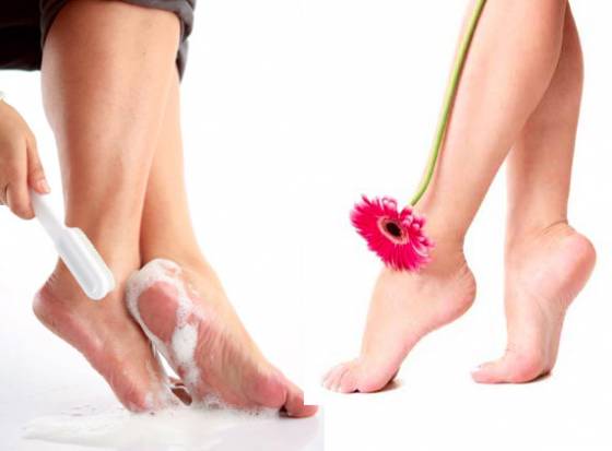 Homemade remedies for cracked heels | Glycerin | Take Paraffin Wax ...