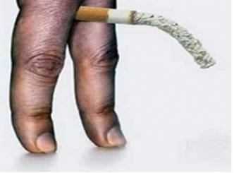 A cigarette a day can take you away from wife!