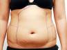 exercise regularly, reduce fat, say no to shortcut methods, Liposuction dangerous