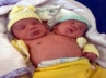 Maria de Nazare, Maria de Nazare, a brazilian woman give birth to a two headed baby boy, Baby boy