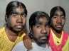 Werewolf syndrome, Monisha Sangli, is there be anyone out there to help these miserable souls, Soul