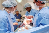 C-section does not affect Autism diagnosis, C-section does not affect Autism diagnosis, autism spectrum disorder in kids is not linked to c section study revealed, Caesar