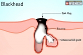 blackheads, Health, 6 ways to remove blackheads, Remove blackhead