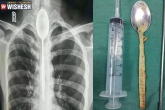 Mr Zhang spoon swallowed, Mr Zhang updates, chinese man swallows spoon stuck in for a year, Zhang qi