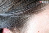 Tips, Tips, home remedies to prevent white hair, Home remedies