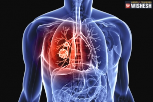 Home Remedies to Treat Lung Cancer