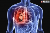 home remedies, home remedies, home remedies to treat lung cancer, Home remedies