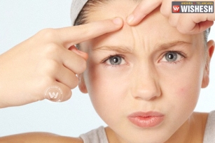 5 Natural Remedies to get rid of Pimples