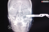 x ray, x ray, pair of scissors sticking out of the head, Pair up