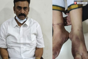Raghu Rama Krishnam Raju&#039;s legs fractured says Medical Report