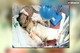 Child eaten away by rats, rats eat child in government hospital, child eaten away by the rats, Government hospital