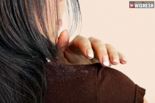 Tips To Stay Away From Dandruff