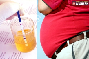 Urine test can determine risk for obesity