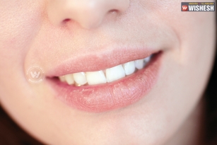 5 remedies for dry Lips