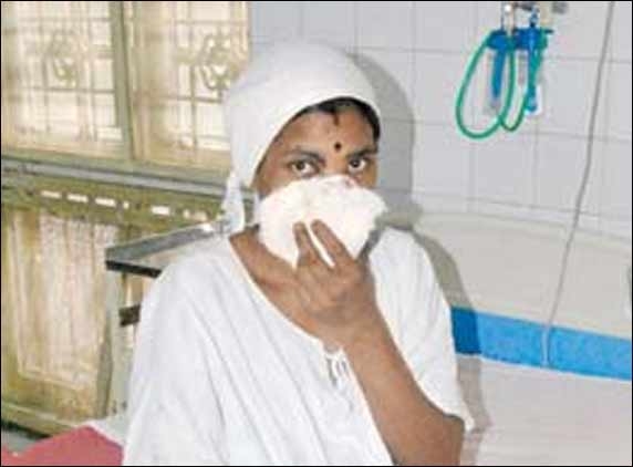 Man, waiting in line for toilet, bites off the nose of a woman